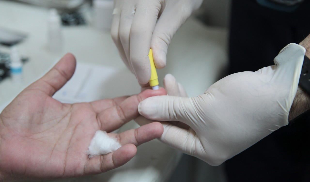 a foto mostra a mão de um enfermeiro fazendo o teste de hepatite com uma agulha no dedo de um paciente